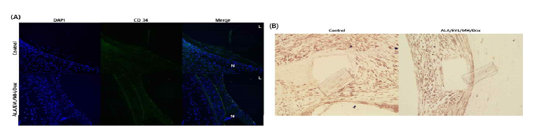 면역형광 염색과 면역조직화학 염색 사진. (A) IF 염색을 통하여 CD 34 발현 사진(N: neointimal area, L: luminal area) 및 (B) IHC DAB을 이용한 a-SMC의 염색 사진