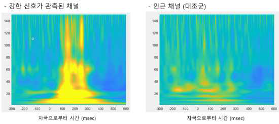 Wavelet 분석으로 탐지해 낸 광자극에 의해 시각 피질에서 감마 영역의 신호 발생