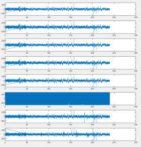 즉각적 16 channel array 수술 실험결과 (X축 : seconds, Y축 :µV)