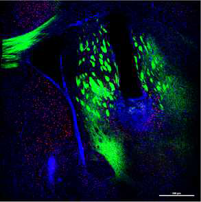 EGFP로 염색된 운동피질에서 dmST로 뻗는 뉴런과 400um fiber가 삽입 되어졌던 자리