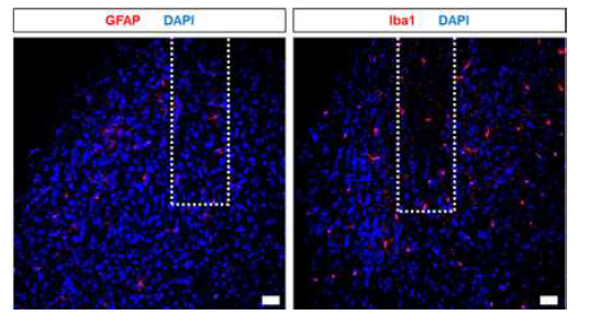 뇌인터페이스 안전성 및 안정성 검증을 위한 해부학적 마커의 확 립. 성상세포(좌측, 붉은색) 및 미세교세포(우측, 붉은 색) 가시화