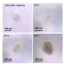 Spherical hippocampal cortical 오가 노이드의 시간에 따른 배양 결과. Seeding 2시 간 후 및 1, 3, 그리고 7 day in vitro (DIV)의 광학이미지 사진