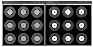 좌: T1 1392 ms, 우: T1 789 ms 의 T1 강조영상
