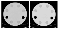 (좌) CT 복원 영상(Brilliance 64 (Philips)), (우) CT 복원 영상(SOMATOM Definition Flash (Siemens))