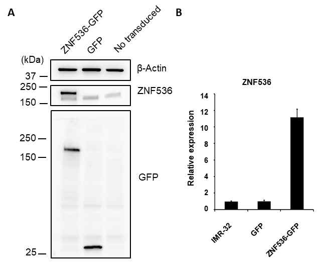 hZNF536-GFP 세포주 동정. IMR32 세포에 hZNF536-GFP를 lentiviral transduction으로 도입하 고, 단백질(A) mRNA (B) 수준에서 hZNF536-GFP의 안정적 발현을 확인함.
