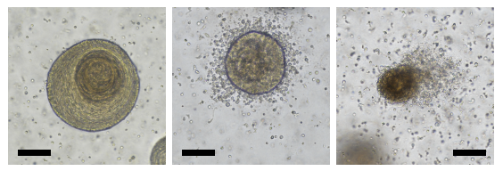 편도 오가노이드-면역 세포 공배양의 현미경 사진진