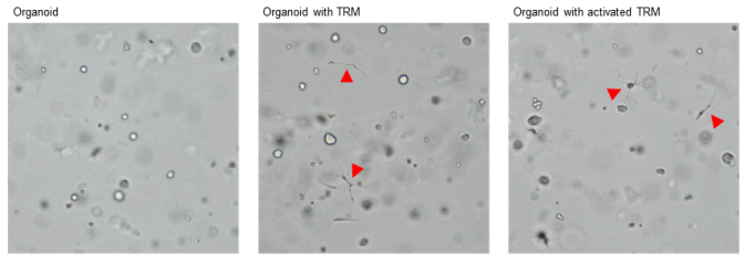 대식세포-암 오가노이드 3차원 공배양 모델의 확립