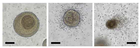 편도 오가노이드-면역 세포 공배양의 현미경 사진