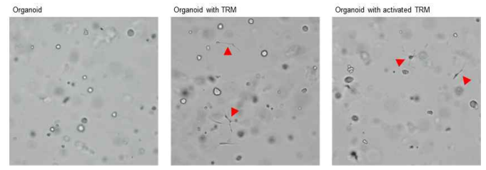 대식세포-암 오가노이드 3차원 공배양 모델의 확립