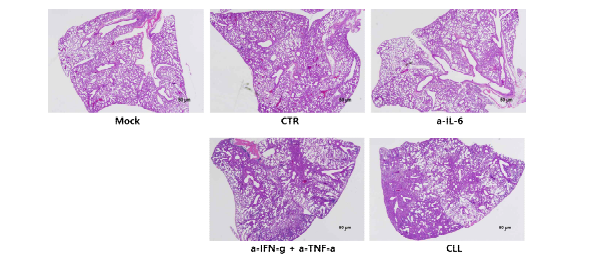 hACE2 Tg 마우스의 면역세포 또는 cytokine 고갈 유도 및 SARS-CoV-2 감염 후 마우스 폐 병변 분석