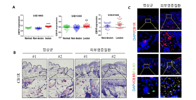 피부염증질환 피부조직의 CB1R 발현 비교·분석