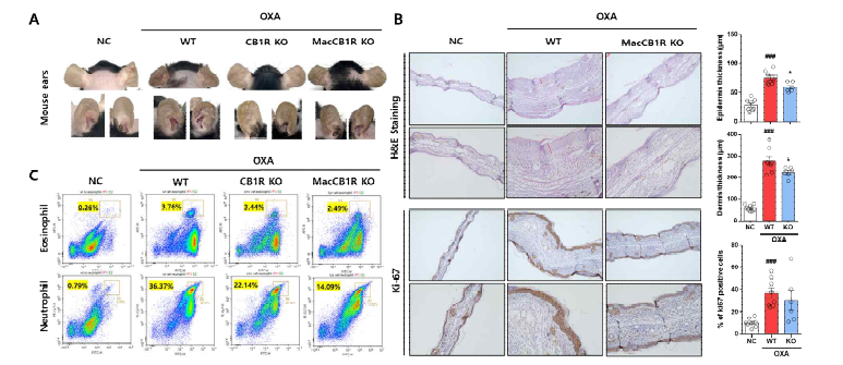 CB1R 결핍 마우스 모델 기반 피부염증질환 (접촉성 피부염)에서 CB1R의 기능 규명
