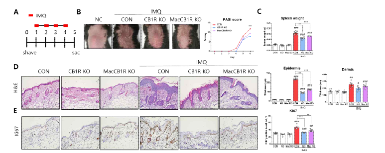 CB1R 결핍 마우스 모델 기반 피부염증질환 (건선)에서 CB1R의 기능 규명