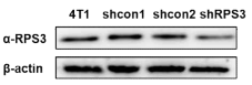 shRNA에 의한 암전이물질 RPS3 발현 억제