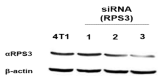 siRNA에 의한 암전이물질 RPS3 발현 억제