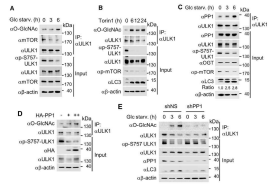 당 결핍 상황에서 ULK1의 O-GlcNAc 수식화와 탈인산화가 일어남을 확인함