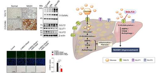 지방간염의 병인 기전 대한 O-GlcNAc 수식화의 역할 규명 연구