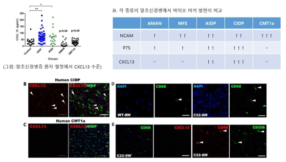 말초신경병증 환자혈청에서 NCAM1, p75, Cxcl13의 검증