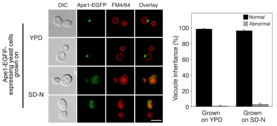 Vacuole inheritance와 Cvt는 동시에 일어날 수 있음