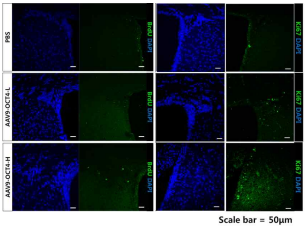 OCT4 농도별 단독 치료 후 초기(2주간) 생성세포 (BrdU+)와 치료 9주후 생성세포(Ki67+)를 면역조직염색 결과