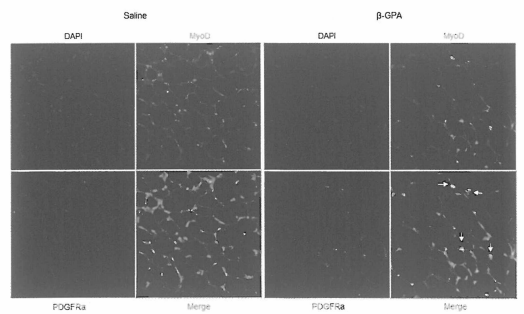 bGPA 주입 마우스의 백색피하지방조직 내 근세포 초기 단백질 MyoD 와 줄기세포 마커인 PDGFRa 면역 형광염색