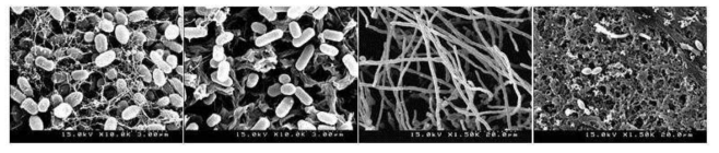 주사전자현미경 (Scanning electron microscopy)를 이용하여 항병원성 물질이 세포의 외부 기질 생산과 세포 모양의 변화를 관찰함