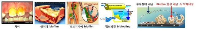 세균의 다양한 생물막(Biofilm)과 항생제 내성 모형