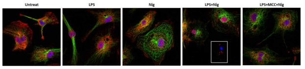 NLRP3 인플라마좀 활성에 의한 세포 내 SOD1 oligomer 확인