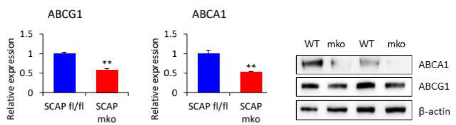 대식세포에서의 ABCG1과 ABCA1의 발현 변화