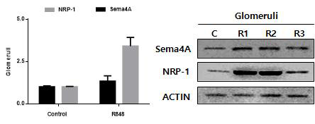 마우스모델의 분리된 사구체에서의 NRP-1과 SEMA4A의 RNA 및 protein 발현