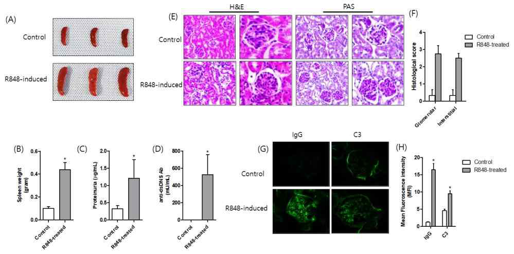 Toll-like receptor 7 agonis-induced lupus model