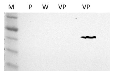 western blot을 이용한 WSSV VP28단백질 발현 확인