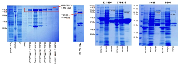 TRIM28 full length (좌) 및 도메인 조합 단백질(우)의 대장균 내 발현