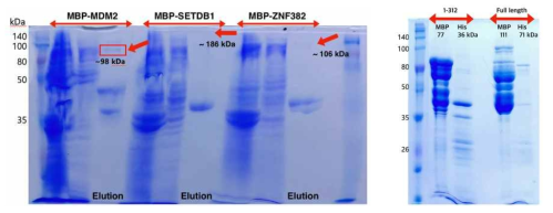 상호작용 단백질 대장균내 발현 테스트 결과 (MDM2, SETDB1, ZNF382: 좌, RLIM:우)