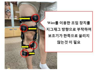 무릎보조기 한쪽 쏠림 현상을 방지하기 위한 지그재그 방향의 와이어 조절장치