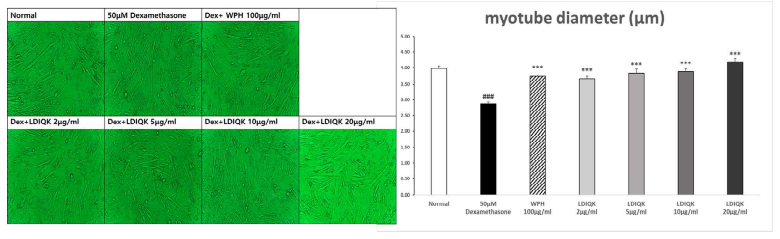 유단백가수분해물과 LDIQK의 처리에 따른 근관세포의 현미경사진 (x400) 및 근관세포 두께 증가