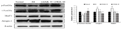 LDIQK 투여에 따른 근 위축 관련인자의 단백질 발현 변화