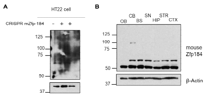 ZNF184 마우스 항체 특이성 검증. (A) CRISPR을 활용하여 Zfp184를 knockout한 마우스 HT22 세포주. (B) 마우스 뇌조직에서 마우스 항체 검증. olfactory bulb (OB), cerebellum (CB), brain stem (BS), substantia nigra (SN), striatum (STR), hippocampus (HIP), cortex (CTX)