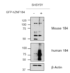 인체 ZNF184를 과발현한 SH-SY5Y 세포주에서 인체 ZNF184 항체와 마우스 Zfp184 항체 특이성 검증