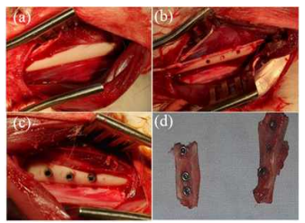 Surgical procedures