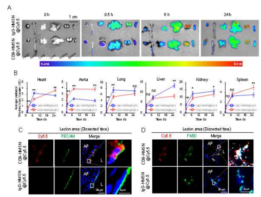 Distribution of CD9-HMSN@Cy5.5 in the atherosclerotic lesions of ApoE-/- . (A) Distribution of IgG-HMSN@Cy5.5 and CD9-HMSN@Cy5.5 in the organs of ApoE-/- . (B) Quantitative analysis of fluorescence distribution. (C) Immunofluorescence staining of CD9-HMSN@Cy5.5 and IgG-HMSN@Cy5.5 with PECAM in frozen tissue sections of atherosclerotic lesions. (D) Immunofluorescence staining of CD9-HMSN@Cy5.5 and IgG-HMSN@Cy5.5 with F4/80 in frozen tissue sections of atherosclerotic lesions