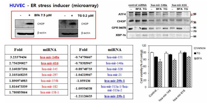 Potential candidates for ER stress-related miRNA in endothelial cells