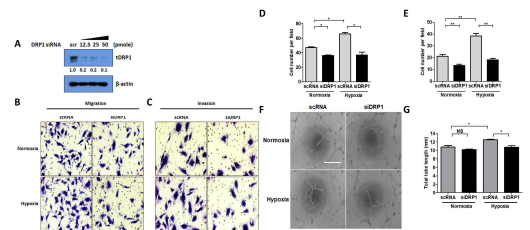 DRP1 RNA간섭에 의해 발현억제후 혈관내피전구세포의 기능이 감소됨을 확인함