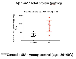 정상 대조군과 알츠하이머 치매 환자의 후각점막내 아밀로이드 단백질 비교