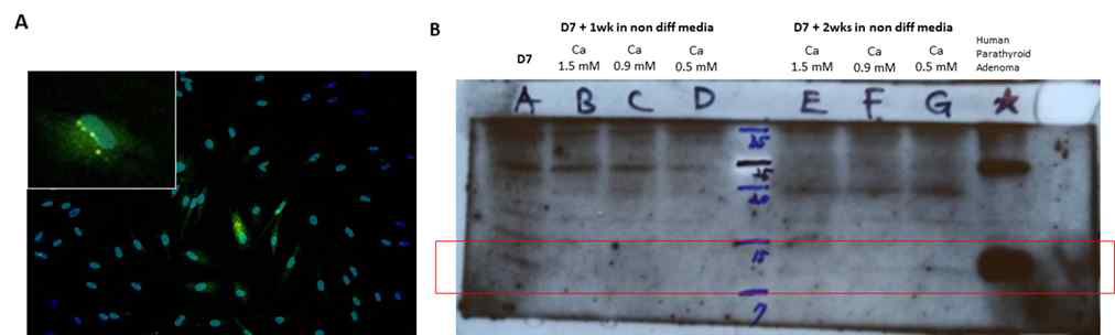 TMSC를 각각 100 ng/mL의 Activin A와 Shh로 PTH 분비세포로 7일 동안 분화시킨 후 (A) Immunofluorescence (GFP: PTH, Dappi: Nucleus) (B) 분화 후 High (1.5 mM), Normal (0.9 mM), or Low (0.5 mM)의 외부 칼슘농도를 가진 미분화 배양액에서 7일 그리고 14일 동안 연이어 배양한 후 Western blotting을 통한 PTH 단백질 발현양 측정 결과.