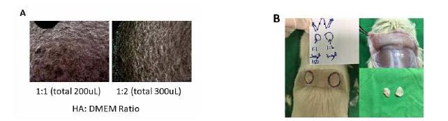 1×106의 TMSC를 HA:DMEM의 비율을 1:1 (total 200uL) 그리고 1:2 (total 300 uL)로 혼합 하여 (A) 세포와 HA의 혼합력을 현미경으로 관찰한 결과. (B) 섞은 혼합물을 쥐의 피하에 주사한 뒤, 다음날 쥐의 피하에 주사된 혼합물을 빼내어 형태와 보존도를 관찰한 결과.