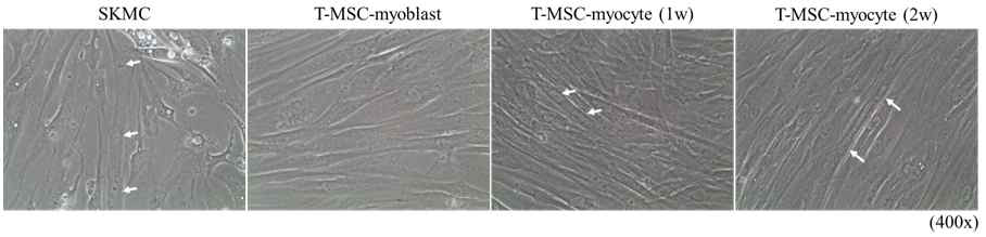 마이크로어레이 분석 전, 엑소좀 추출에 사용된 세포들. 화살표: myotube형태, 다핵세포를 가리킴.
