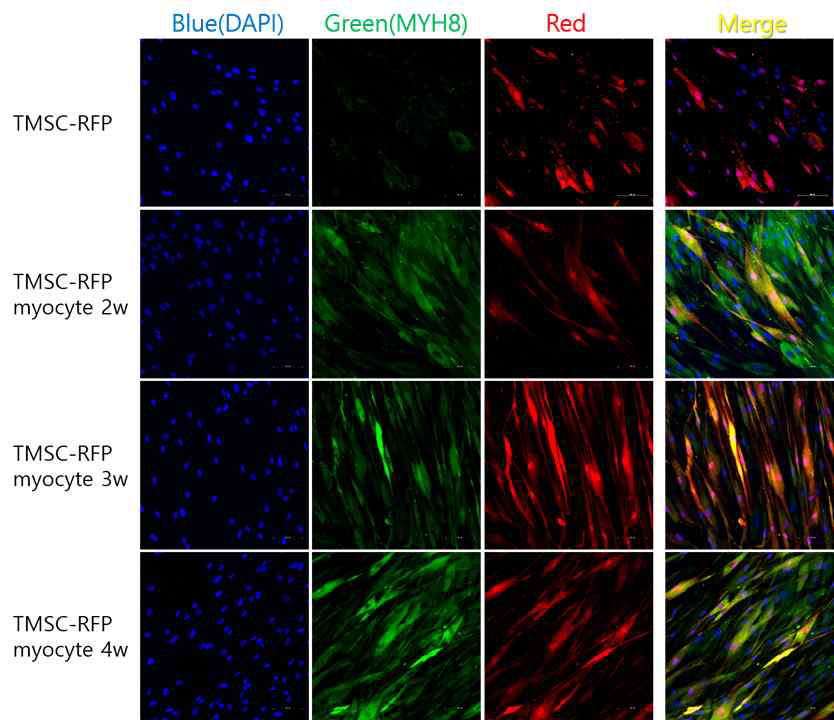 이식용 TMSC-RFP-myocyte의 근육세포로의 분화 확인: Blue (DAPI); Green (myosin heavy chain 8, MYH8); Red (RFP) x200.