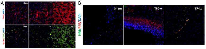 TMSC-myocyte를 mdx mice에 이식한 후 체내 효능 검증. A. 이식 부위인 비복근의 재생을 확인하기 위하여 조직면역염색함. VEGF (red); NF-H (red); α-BTX (green). B. 이식된 TMSC-R-myocyte의 잔류기간과 분포를 확인. HM (green); RFP (red); DAPI (blue); merge (yellow); 배 율 x100. TP, T-MSC-myocyte를 이식한 실험군; Sham, PBS만 이식한 실험군; W/T, wild type (양성대 조군)