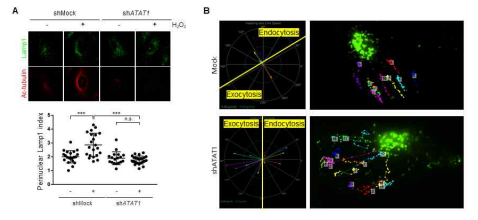 Live microscope를 통한 aTAT1결손 세포의 Lamp1 vesicle movement의 변화분석